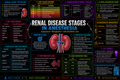 RENAL / AKI Staging – Anesthesia Mind Map