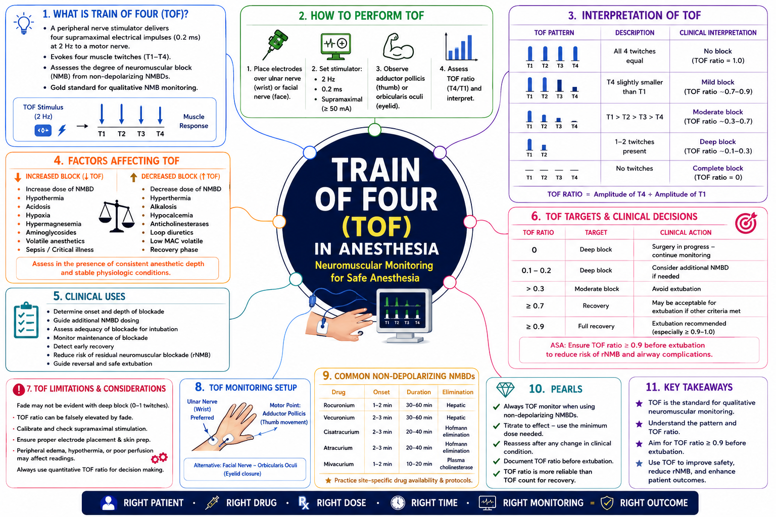 Train-of-Four (TOF) – Anesthesia Mind Map