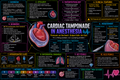 Tamponade (Alt Design) – Anesthesia Mind Map